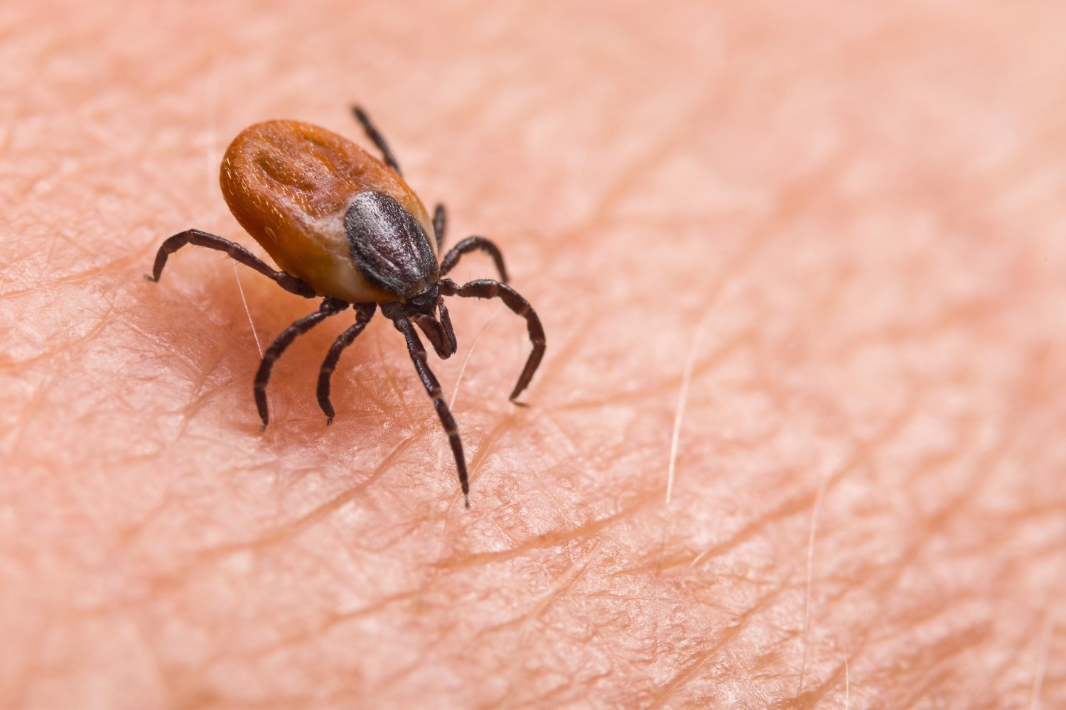 Přenos ledviny s nevítaným spolujezdcem: smrtící klíštěcí bakterie